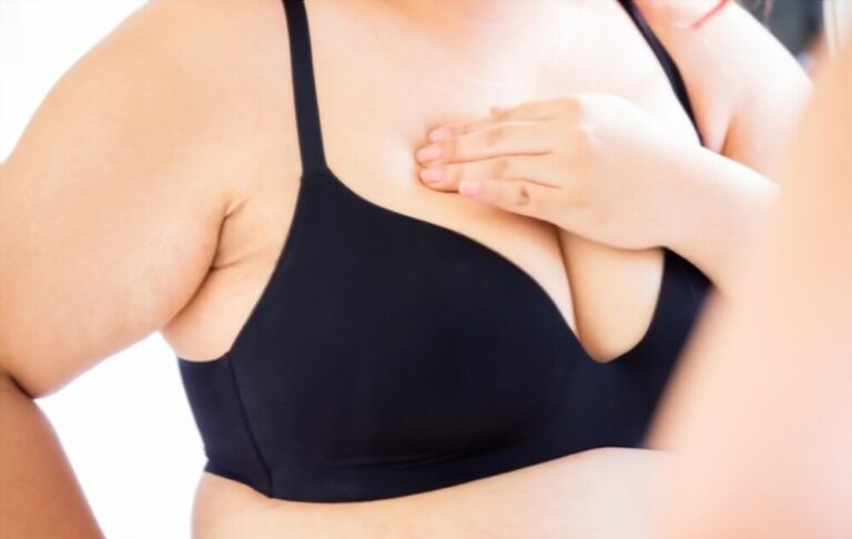 A obesidade é um fator agravante do câncer de mama?