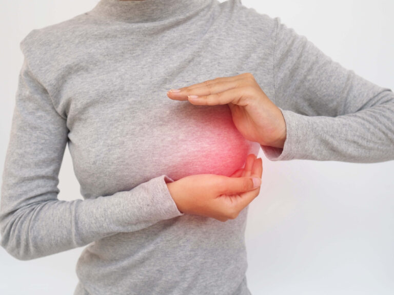 O que é a coceira no mamilo?